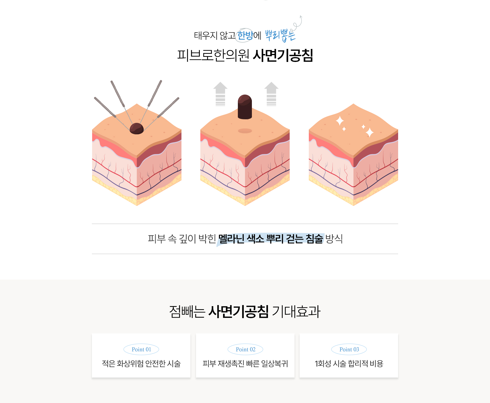 점빼기